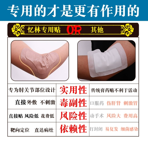 Теннисной локоть кремовый кремовый пластырь защищает боль, кислый, слабый, горячий сжатие минометного раствора плечевой кости, внешний крикет, локоть GH