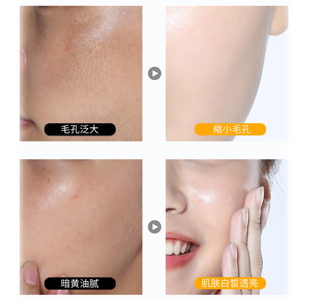Làm sạch sâu lỗ chân lông độc tố rạng rỡ làm sạch da để làm bẩn những thứ bẩn kem massage vi tinh thể xác thực - Kem massage mặt kem massage mặt