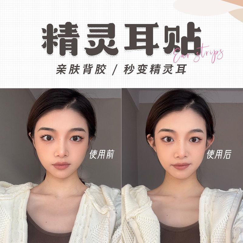 Elf ear bead veneer ear correction standing ear bead stereotyped change to attract wind ear artifact ear support stick fixed ear support