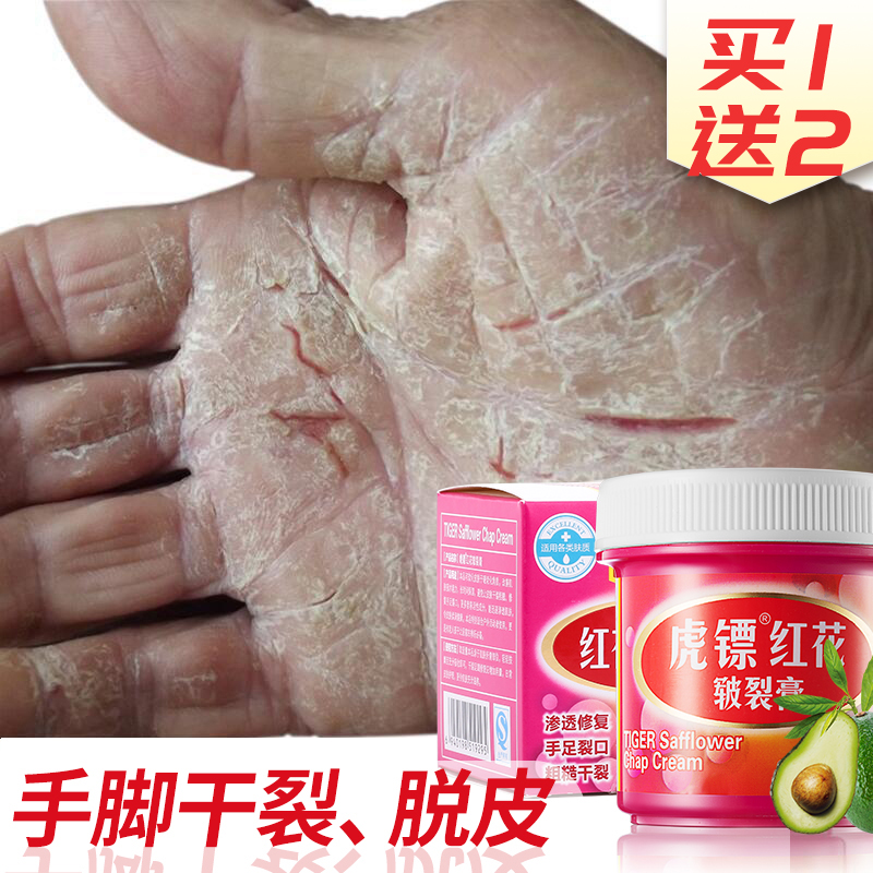 Hands And Feet Cracked Dry Crack Repair Cream Dry Rough Cracks Protective Hands Foot Cracked Peeling Winter Feet Heel Anti-Cracking Cream