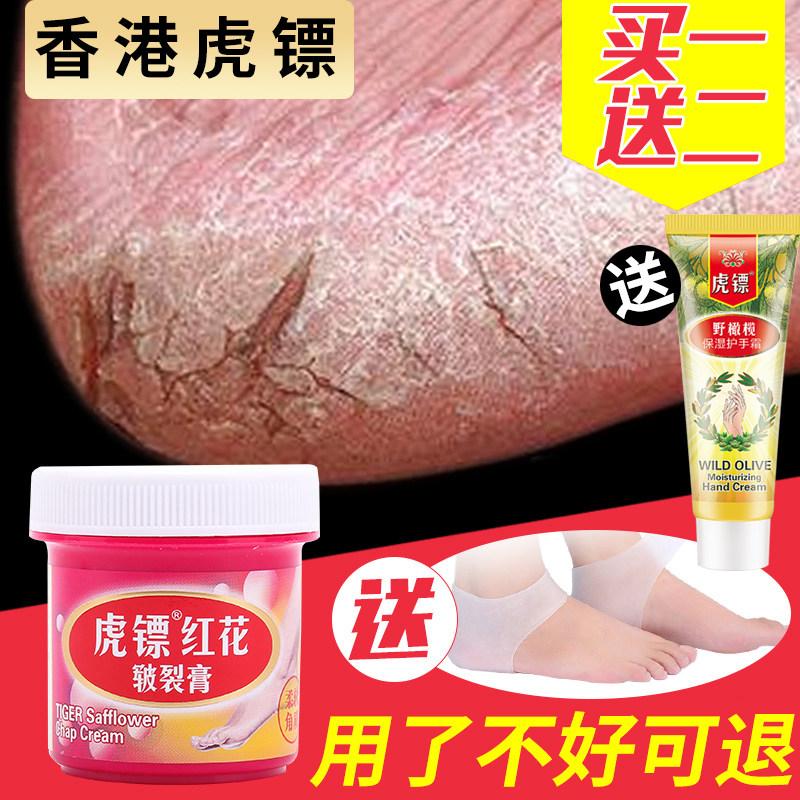Cracked heel repair cream Cracked anti-cracking cracked hands and feet cracked chapped cream Horse oil frostbite peeling of hands and feet