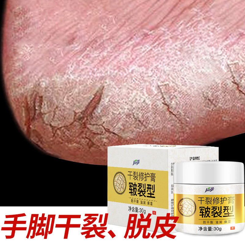 Heel dry crack repair cream crack horse oil frostbite cream anti-crack crack protection hand and foot crack healing winter