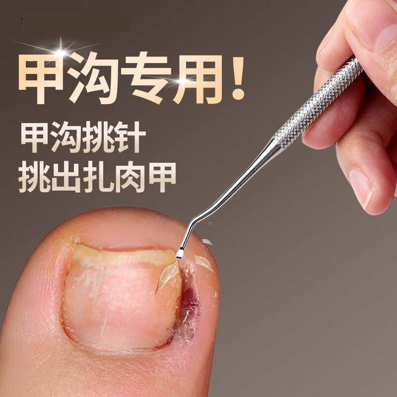 Specialized Tool for Cleaning Nail Grooves, Removing Dirt from Toenail Seams, and Correcting Ingrown Nails; Pedicure Tool Specialized Tool for Cleaning Nail Grooves, Removing Dirt from Toenail Seams, and Correcting Ingrown Nails; Pedicure Tool