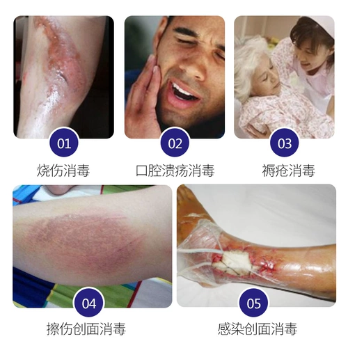 BestRei Композитный растворимый виноградный фермент дезинфекция распыляет ожоги ожоги ожоги