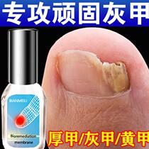 (Painless to stubborn gray armor) gray nail special antibacterial solution to remove thickening empty armor Ash