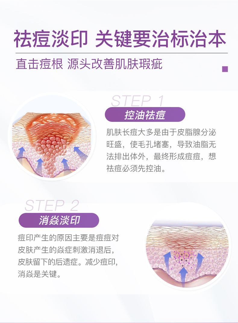 贺柏圣祛痘淡印片+B族维生素淡印修复片