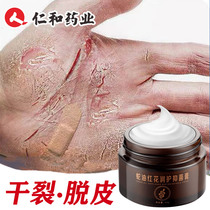 Riners and hands and feet crack opening dry crack repair cream drying rough cracks protective hands foot cracked peeling anti-crack cream Cracked Cream
