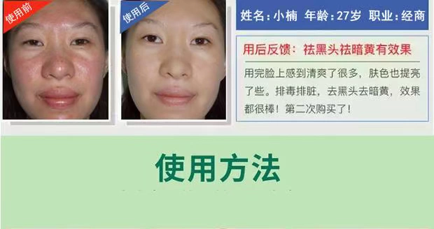 Chính thức xác thực nuôi dưỡng trẻ hóa da mặt độc tố massage mặt kem kem làm sạch sâu lỗ chân lông