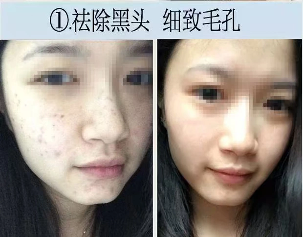 Chính thức xác thực nuôi dưỡng trẻ hóa da mặt độc tố massage mặt kem kem làm sạch sâu lỗ chân lông