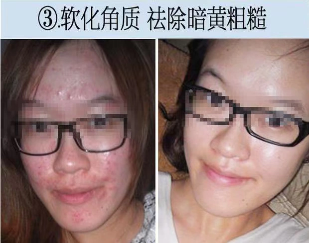 Chính thức xác thực nuôi dưỡng trẻ hóa da mặt độc tố massage mặt kem kem làm sạch sâu lỗ chân lông