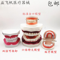 Dental Teaching Model Teeth Model Denture Tooth Decay Model Kindergarten Teaching Extra-dental Models