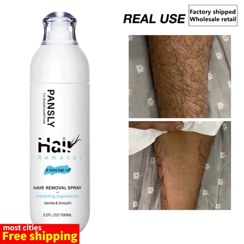 Рост волос на лицевой лице