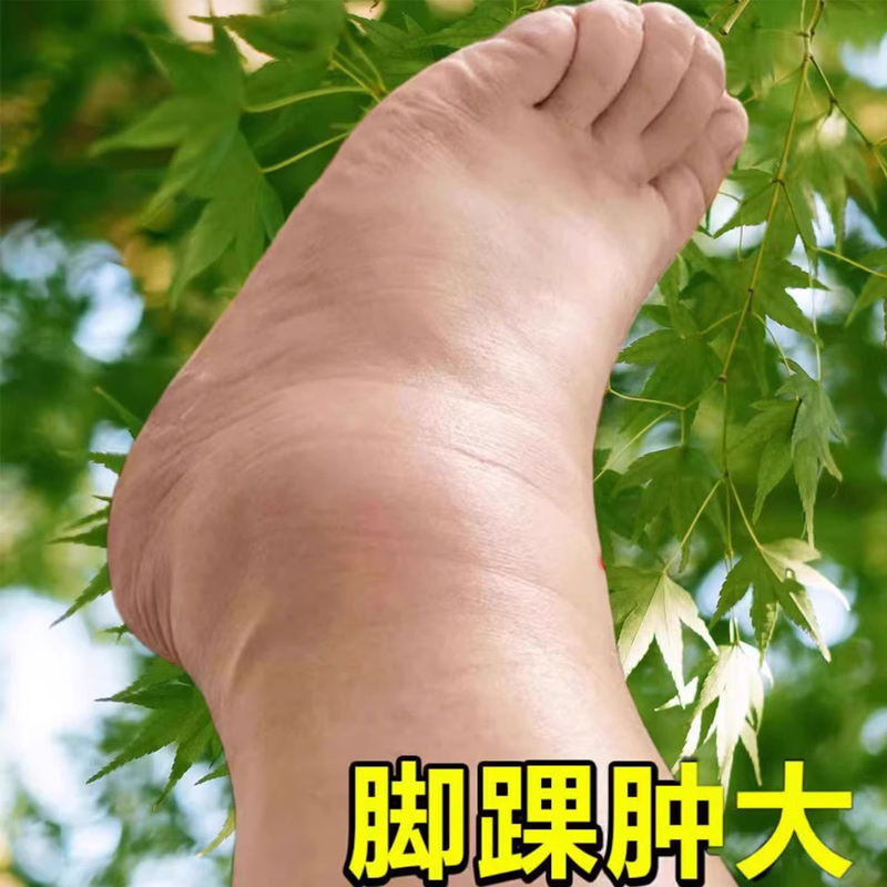 Ankle Injury, Sprained Ankle, Walking Aid, Sprained Ankle, Hot Compress, Ankle Ligament Strain Recovery