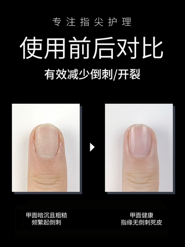 Магазин возвращается к более чем 10 000 цветов xix finger nuvence ручка, анти -дух