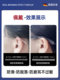 Anti-wear and anti-slip glasses