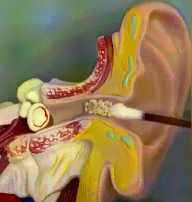 04.gif