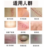 Гель, мазь от ожогов, осветляющий послеродовой бондаж, крем от шрамов