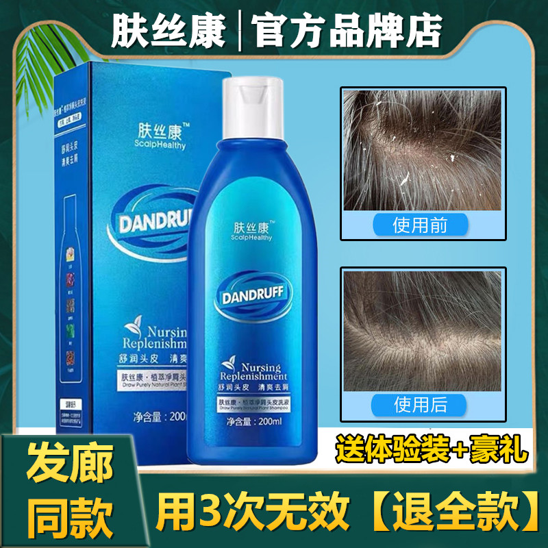 Lingge Fusikang Anti-Dandruff Shampoo Plant Extraction Scalp Cleansing Lotion Scalp Cleansing Plant Anti-Dandruff Itching Control Oil - Taobao