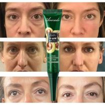 7 Days Instant Remove Wrinkles Eye Cream Anti Dark Circles B