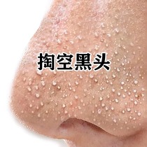 (Watson’s Popular) Removes dirt and pore garbage deep cleanses and shrinks pores for men and women buy 2 get 1 free