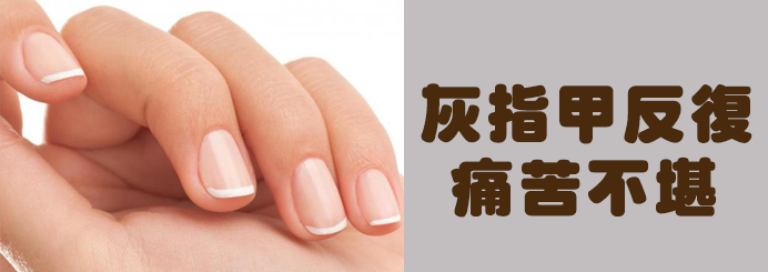 灰指甲常年 反覆 發作超困擾 研究灰指甲10年獲重大突破 健甲漢方 徹底改變230萬灰指甲患者命運