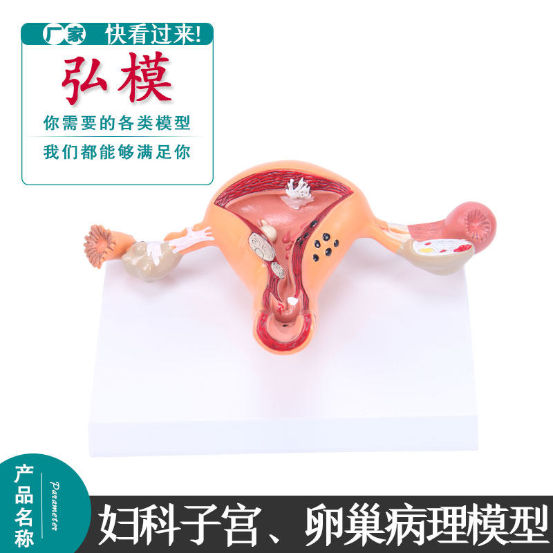 弘模妇科子宫卵巢病理展示女性子宫卵巢阴道疾病模型生殖科妇产科