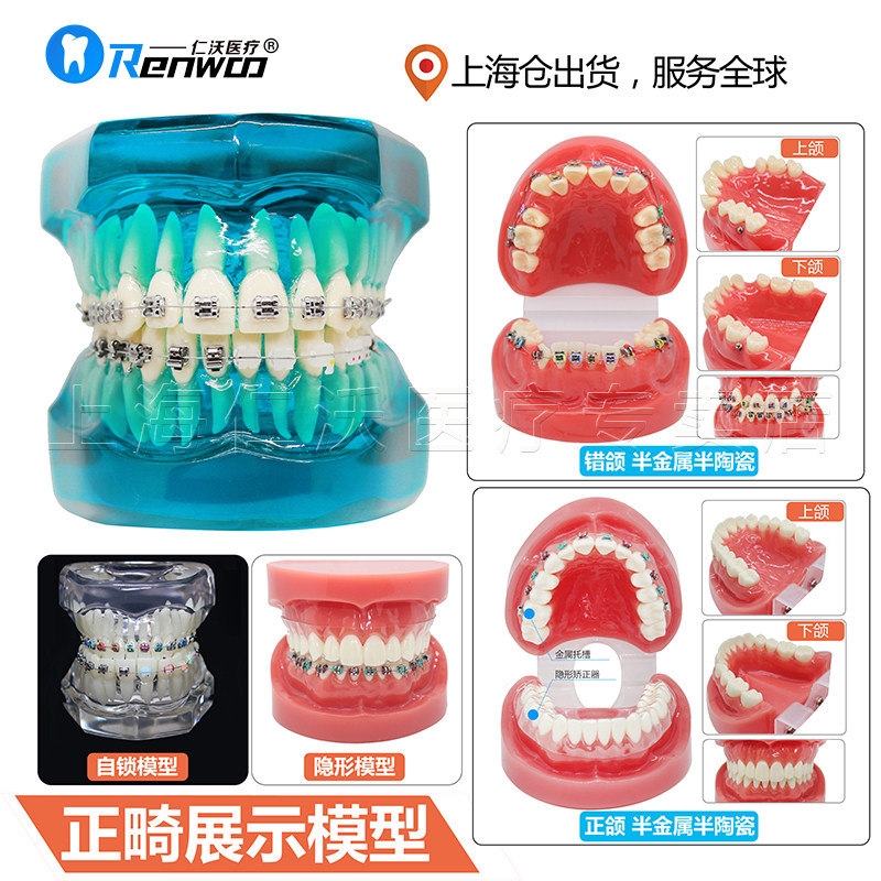 Dental Self-Lock Nursery Trough Orthodontic Tooth Model Ceramic Nursery Trough metal Deslot Self-lock Slot Contrast Model