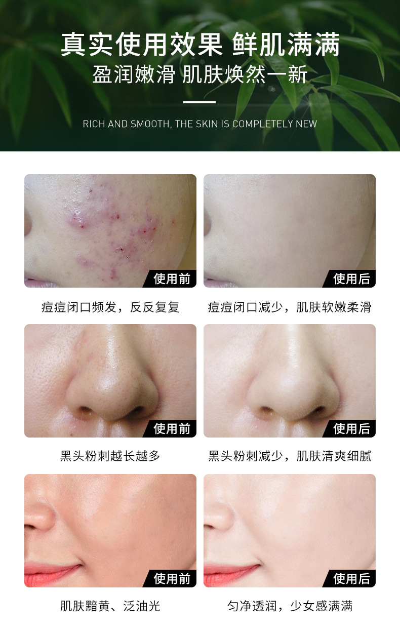 Dream Xilan Cleansing Micro Crystal Renewal Cream 50g Cleansing Pore Discharge To Dirty Facial Massage Cream Beauty Salon Có sẵn - Kem massage mặt kem tẩy trắng da toàn thân