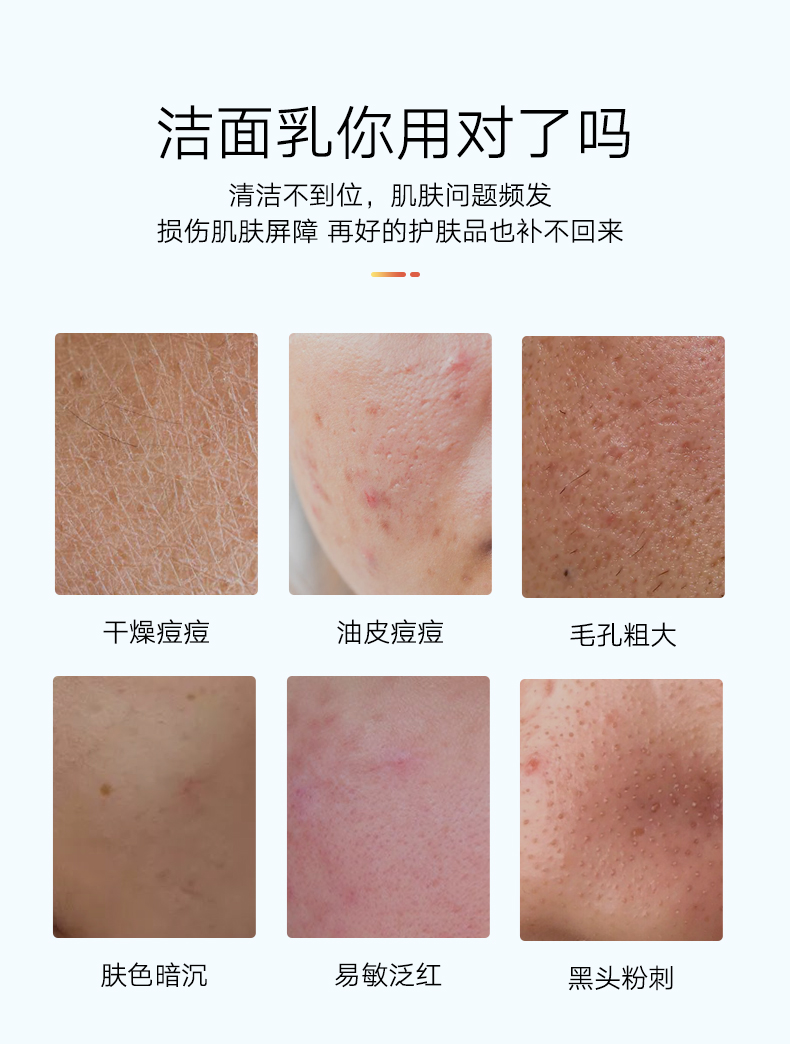 Snow Lingli Amino Acid Giặt Sữa Kem dưỡng ẩm cho nam Làm sạch độ sâu Làm sạch Pore Pore Nữ Loại bỏ Mitre Cleansing sữa rửa mặt uriage