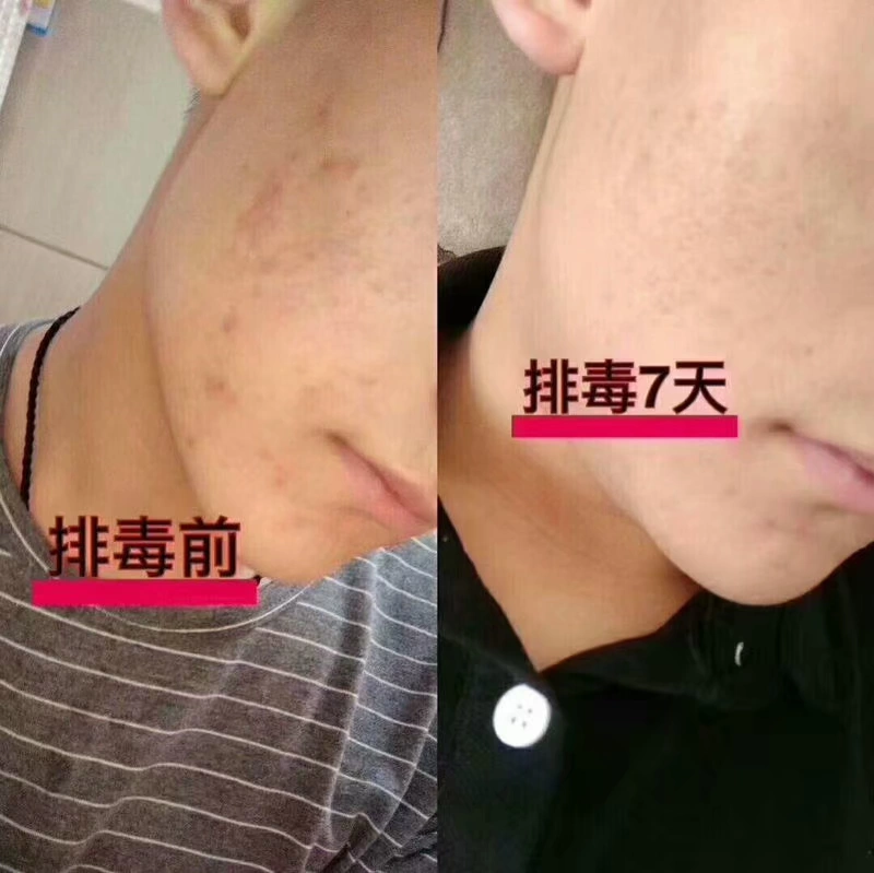 草 集 净化 Kem làm sạch sâu lỗ chân lông hàng kem dưỡng da mặt độc tố nữ chính hãng