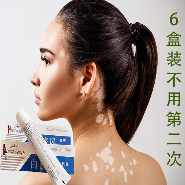 Vitiligo ointment ລົບຈຸດລົມ, ສົ່ງເສີມການຈະເລີນເຕີບໂຕຂອງ melanin, ກໍາຈັດແຜ່ນ, six-pack, ຟື້ນຟູຜິວຫນັງ, ບໍ່ປົກຫຸ້ມຂອງແທ້.