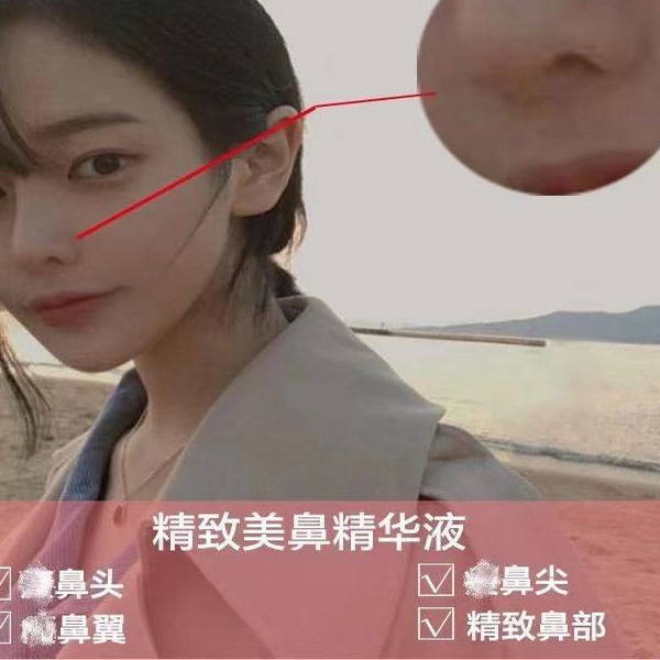 Exquisite Nose Beauty Oil Essence Reduces the Size of the Nose Tip, Nostrils, and Large Nose, Making It Smaller and Improving the Appearance of a Bulbous or Wide Nose