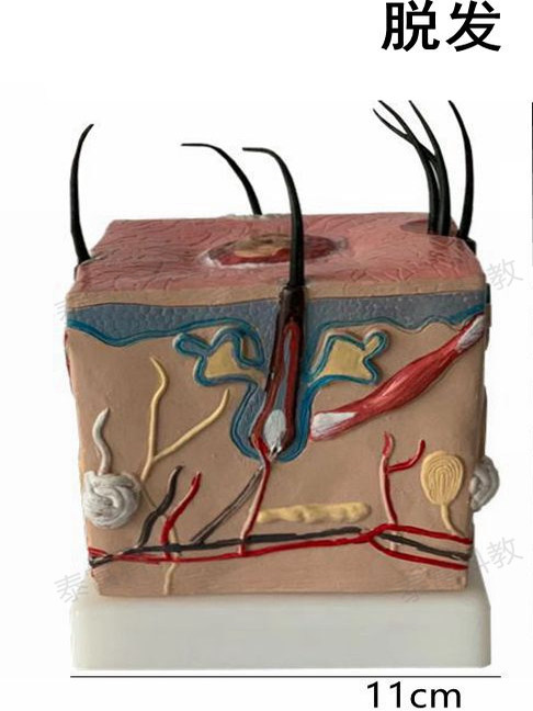 Hair Loss Model, Hair Pathology, Scalp Structure, Hair Growth Process, Human Skin Anatomy, Magnified Micro-Plastic Surgery