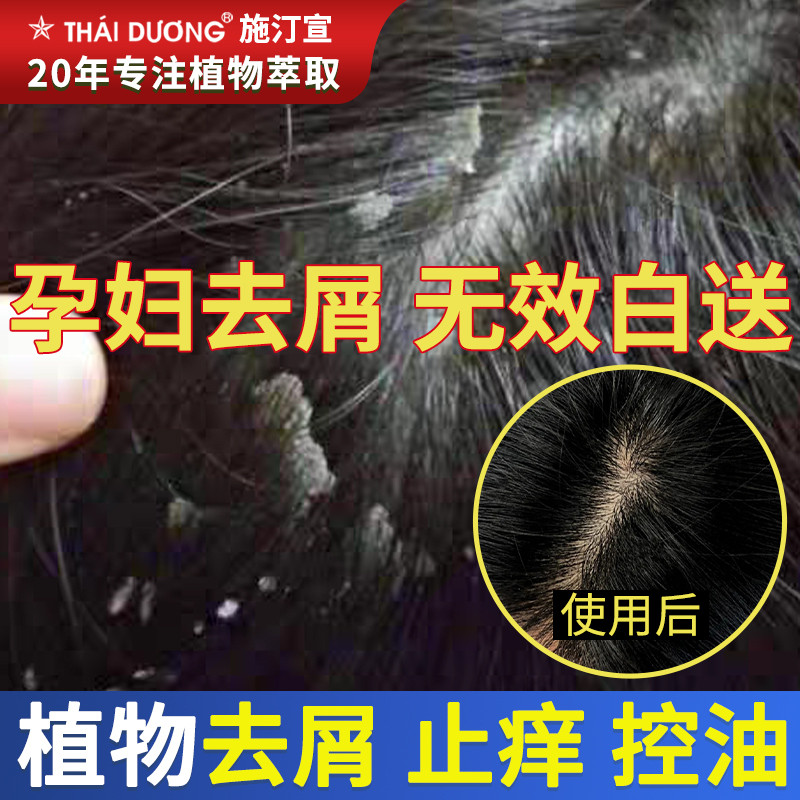 Pregnant woman shampoo pregnant woman Special shampoo available shampoo Shampoo Shampoo for Cuttings Severe Control Oil Period