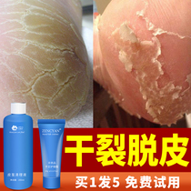 Foot peeling dry cracking dry peeling cracked skin cracked skin summer molting heels non-exfoliation non-repair cream