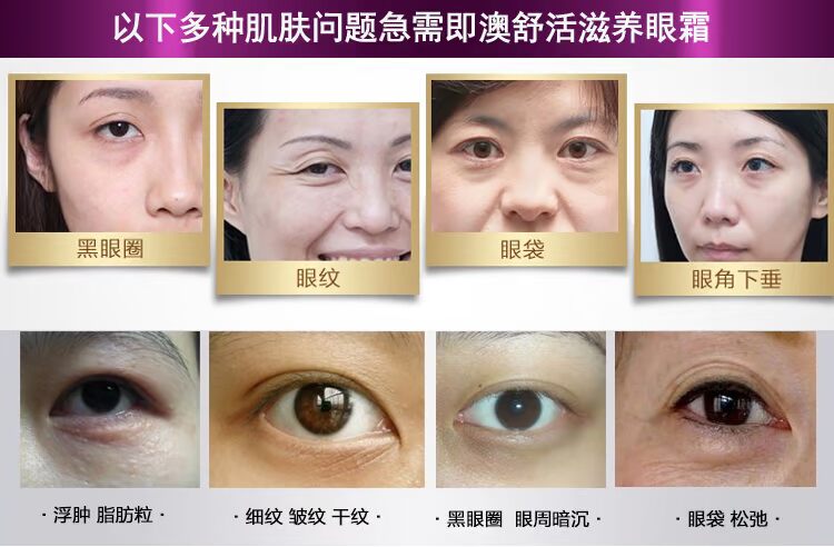 Eye Serum Eye Cream to Fine Line Firming Lift Cream Eye Moisturising Hydrating to Dark Circle Eye Care mặt nạ mắt trị thâm