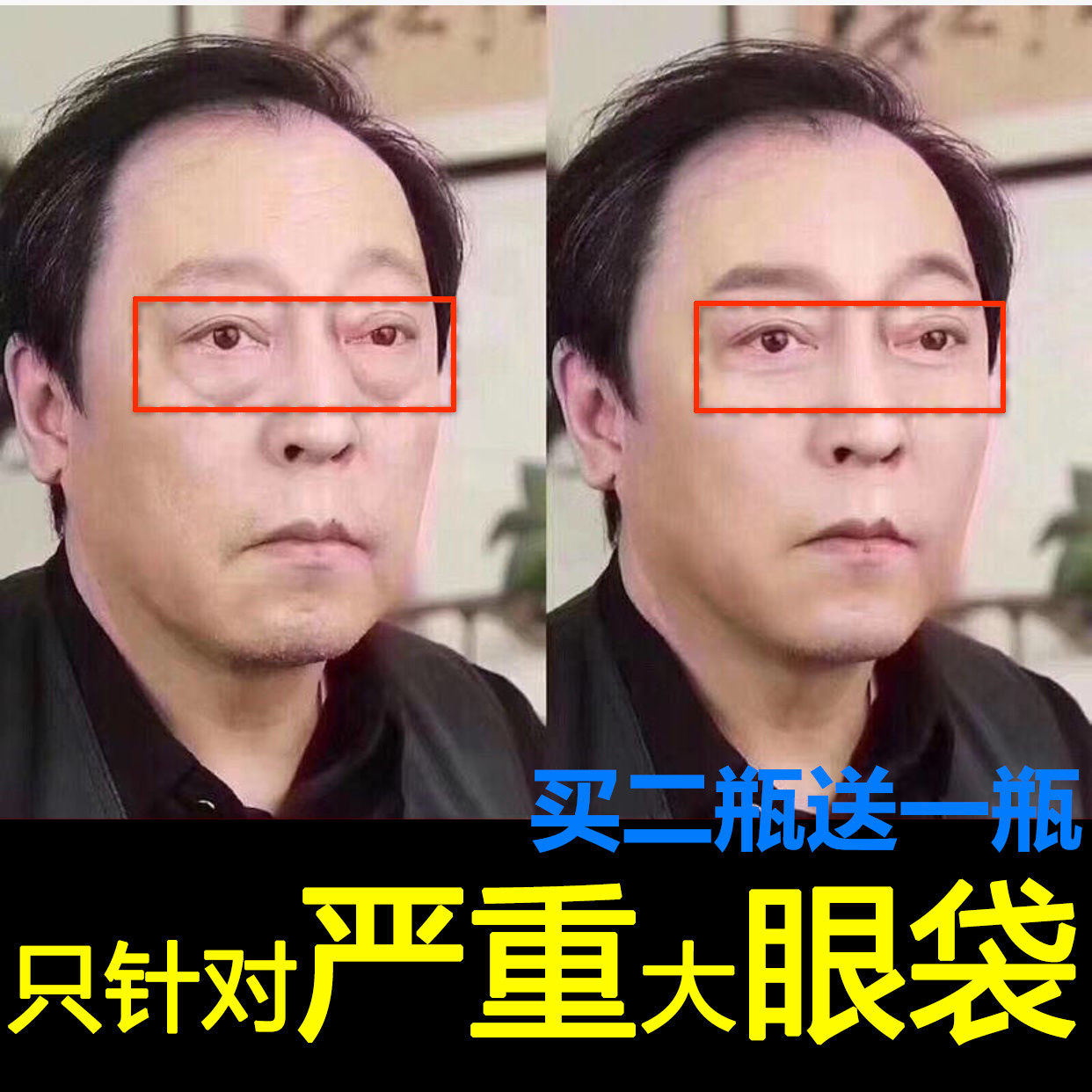 Elimination of the black eye ring to remove the eye bag Bloated Swollen God Eye Band Cream Men Special Eye Cream Male Disdain