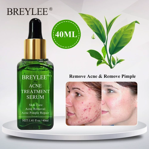 BREYLEE ACNE TREATMENT SERUM эссенция против прыщей 40 мл для удаления черных точек, пор, борьбы с прыщами и восстановления