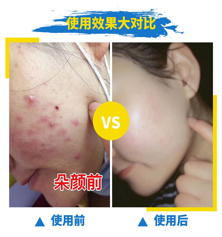 Bộ đôi kem dưỡng da mặt chính hãng nước sửa chữa dưỡng ẩm thu nhỏ lỗ chân lông làm sáng màu da sữa dưỡng ẩm