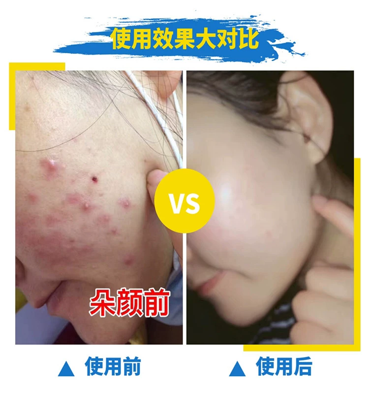 Bộ đôi kem dưỡng da mặt chính hãng nước sửa chữa dưỡng ẩm thu nhỏ lỗ chân lông làm sáng màu da mặt nạ ngọc trai