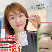 Runbai Yan Shuoshui times to throw 377 hyaluronic acid raw liquid facial essence muscle Foundation moisturizing and brightening skin 5 sets