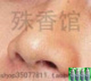 Various Types of Chronic Nasal Congestion Nasal Washs - Shushuangdian Various Types of Chronic Nasal Congestion Nasal Washs - Shushuangdian