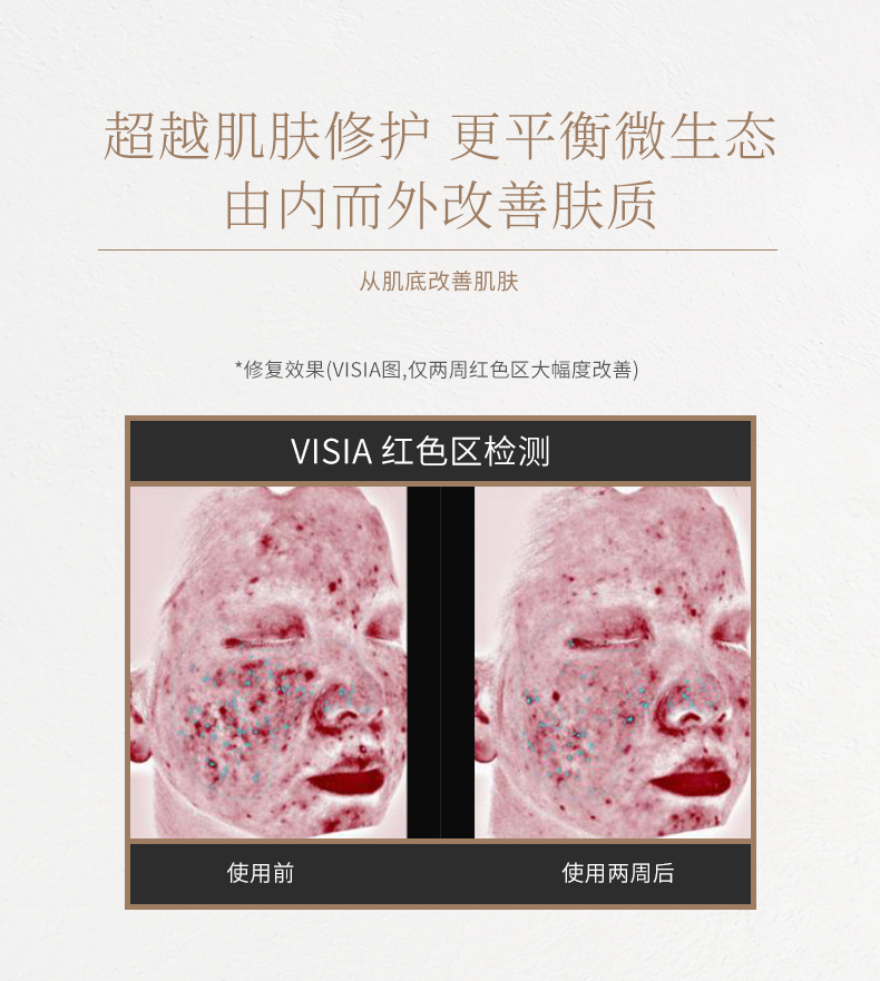 Rookie and Formulator Muscle Foundation Tinh chất chống mụn Curcumin chống mụn nhạy cảm Muscle Repairing Acne Marks Dull 30ml serum 2