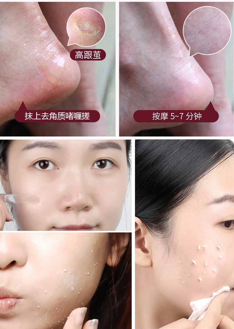 Tẩy tế bào chết Gel tẩy tế bào chết cho da mặt Làm trắng da toàn thân Giữ ẩm cho mụn đầu đen và phụ nữ nhẹ nhàng tẩy tế bào chết tẩy tế bào chết ngọc trai