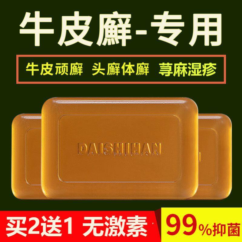 Medicinal Soap Urticaria Special Ointment Urticaria Eczema Yang 1 Family To Treat Neuropathic Persistent Chronic Dermatitis