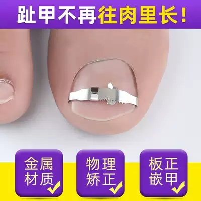 正甲扣甲沟矫正贴脚指趾甲嵌甲正甲贴神器专用指甲刀钳炎卷甲器