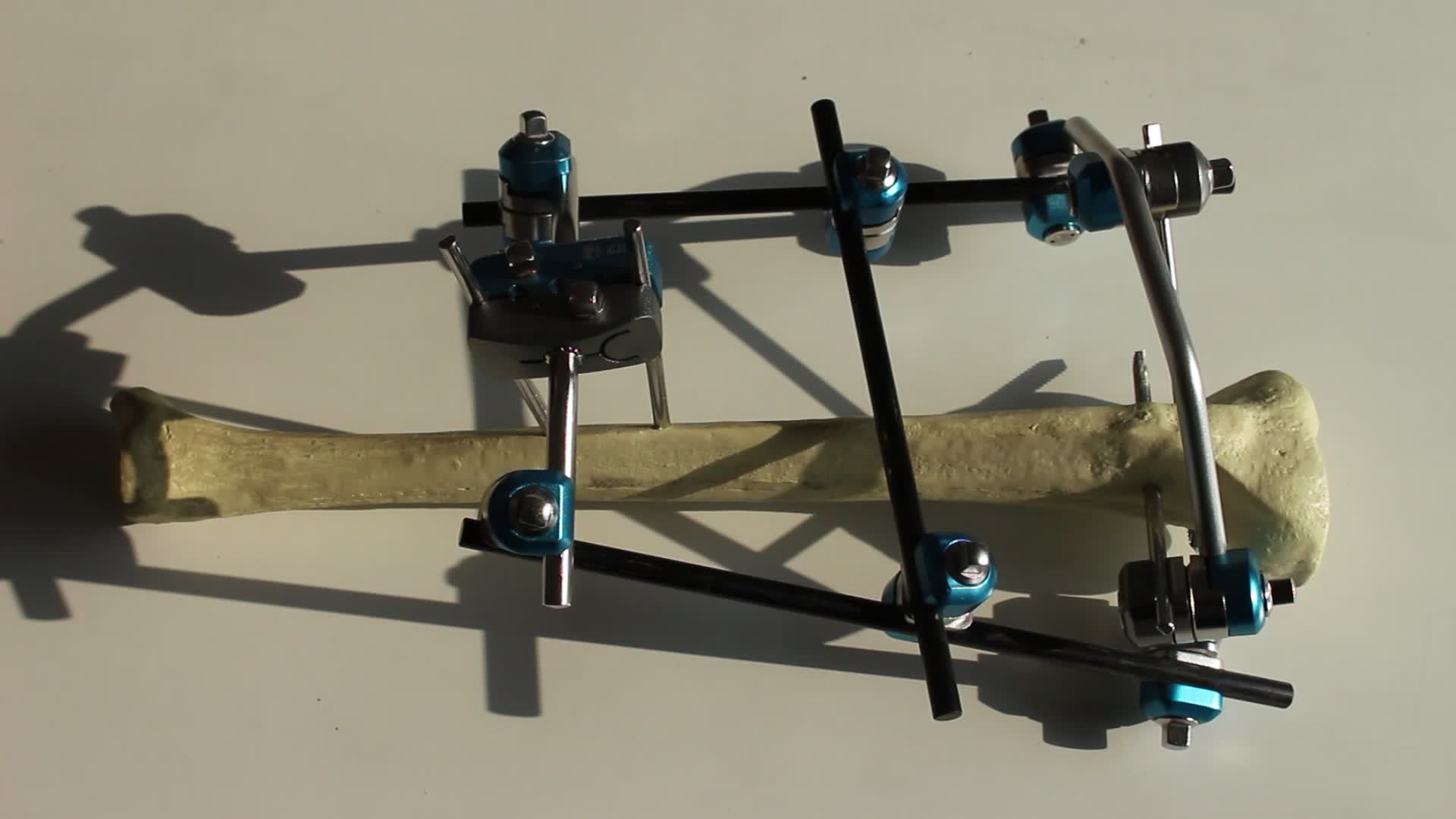 Orthopedic Instruments Ilizarov,Bone Lengthening External Fixator Screw