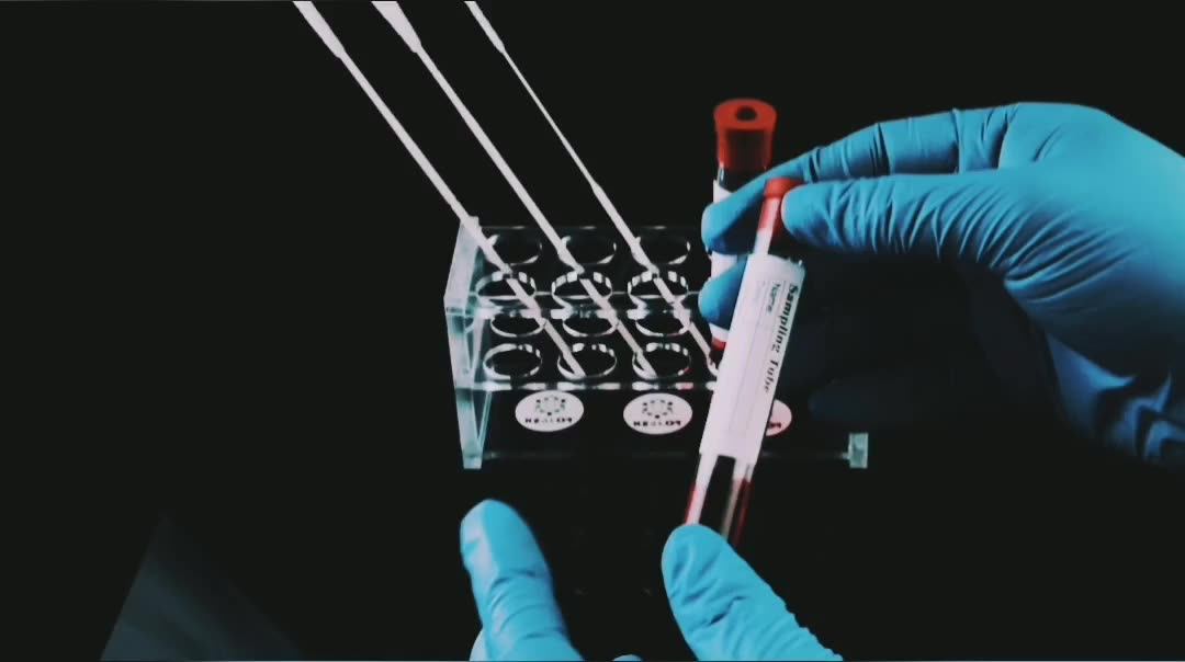 Universal Viral Transport Collection Kit Lab Tube Vtm With Nasal Swab