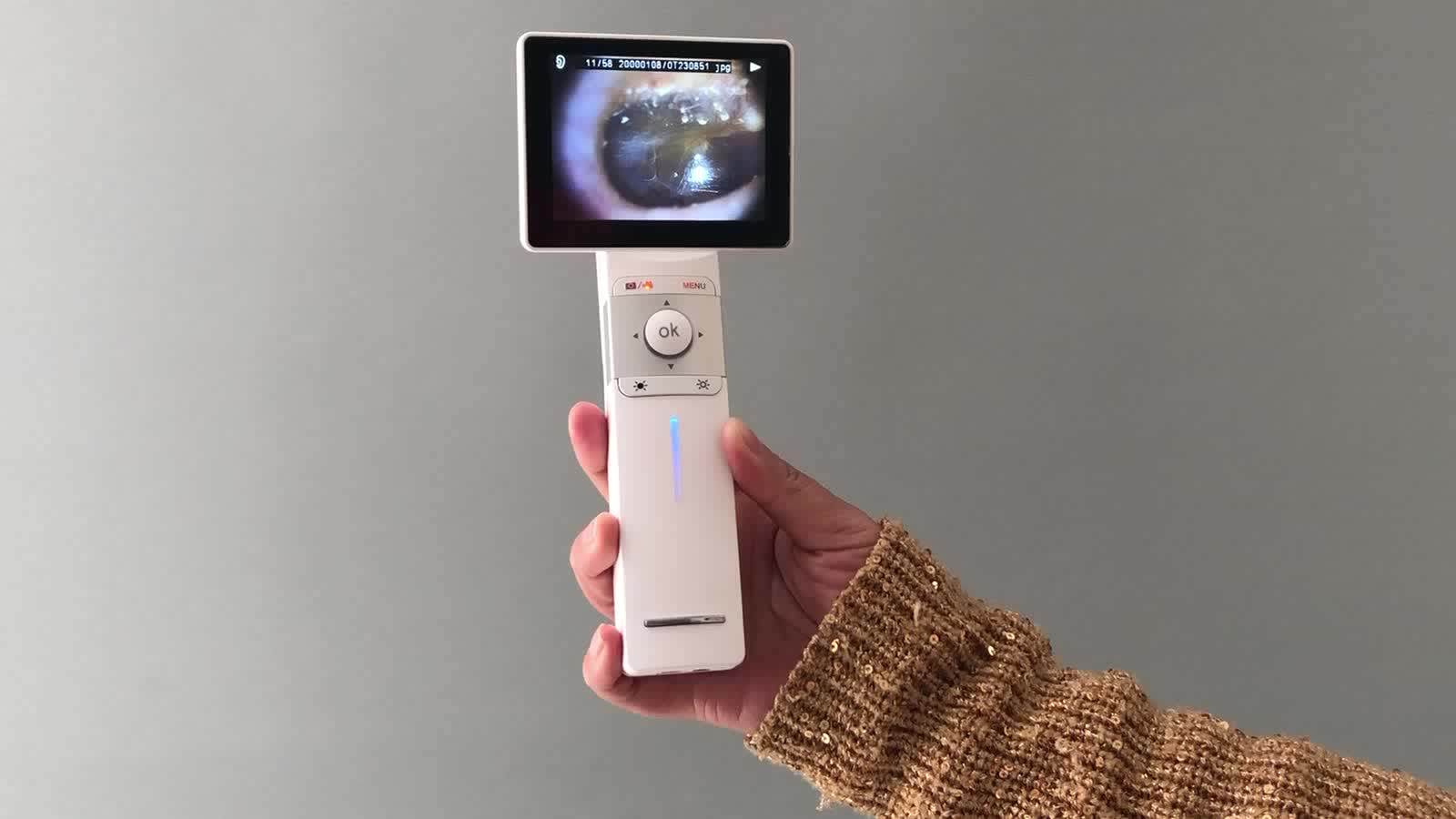 Surgical Ent Endoscope Ear Camera Handheld Otoscope Ear Microscope