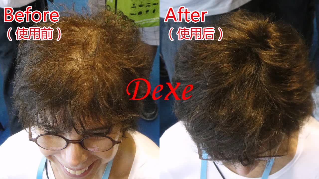 Dexe Hair Thicker Instantly Hide Bald Spots Product Hair Loss